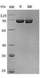 SDS-PAGE (F13A1-1330H).jpg